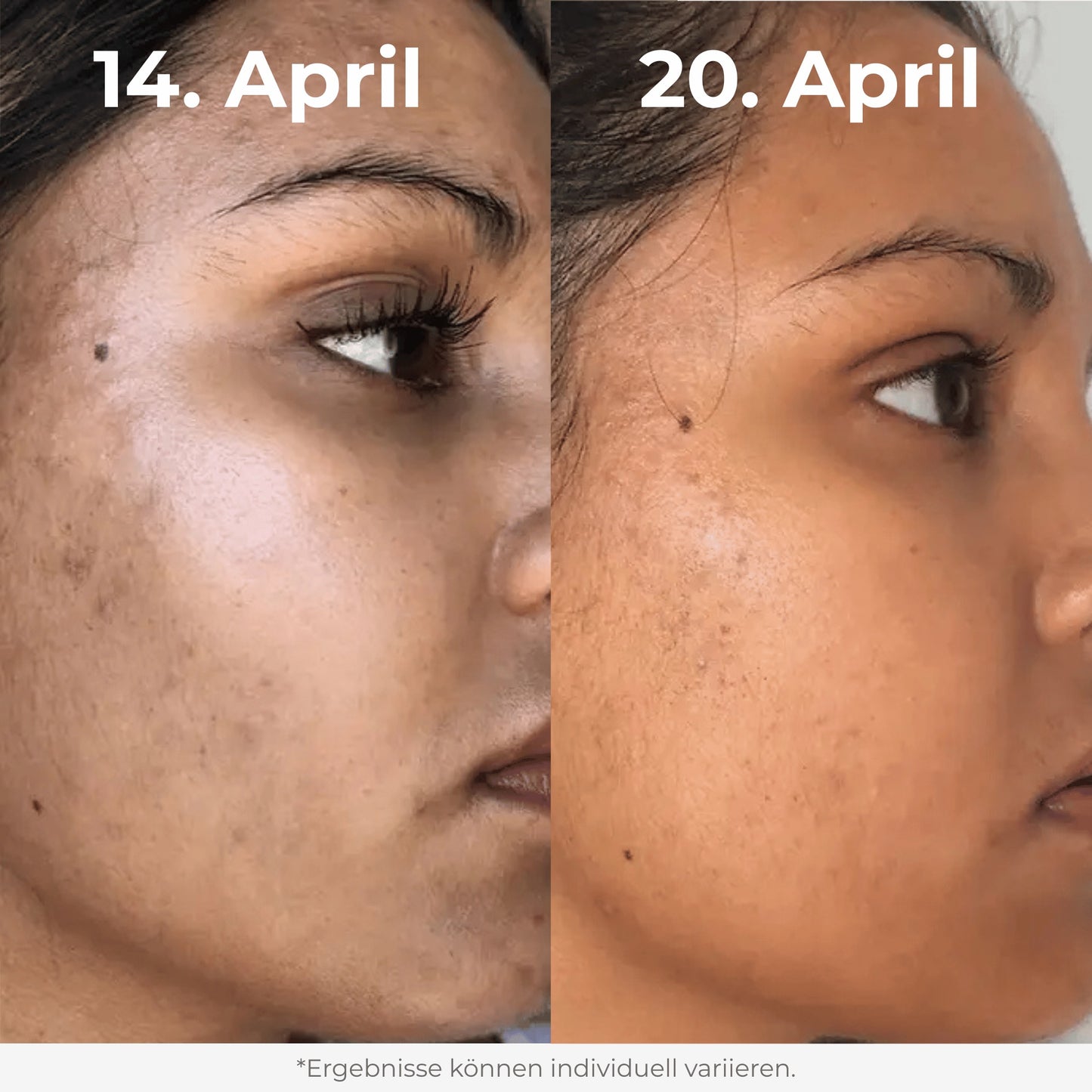 Glow Reis Peeling Duo