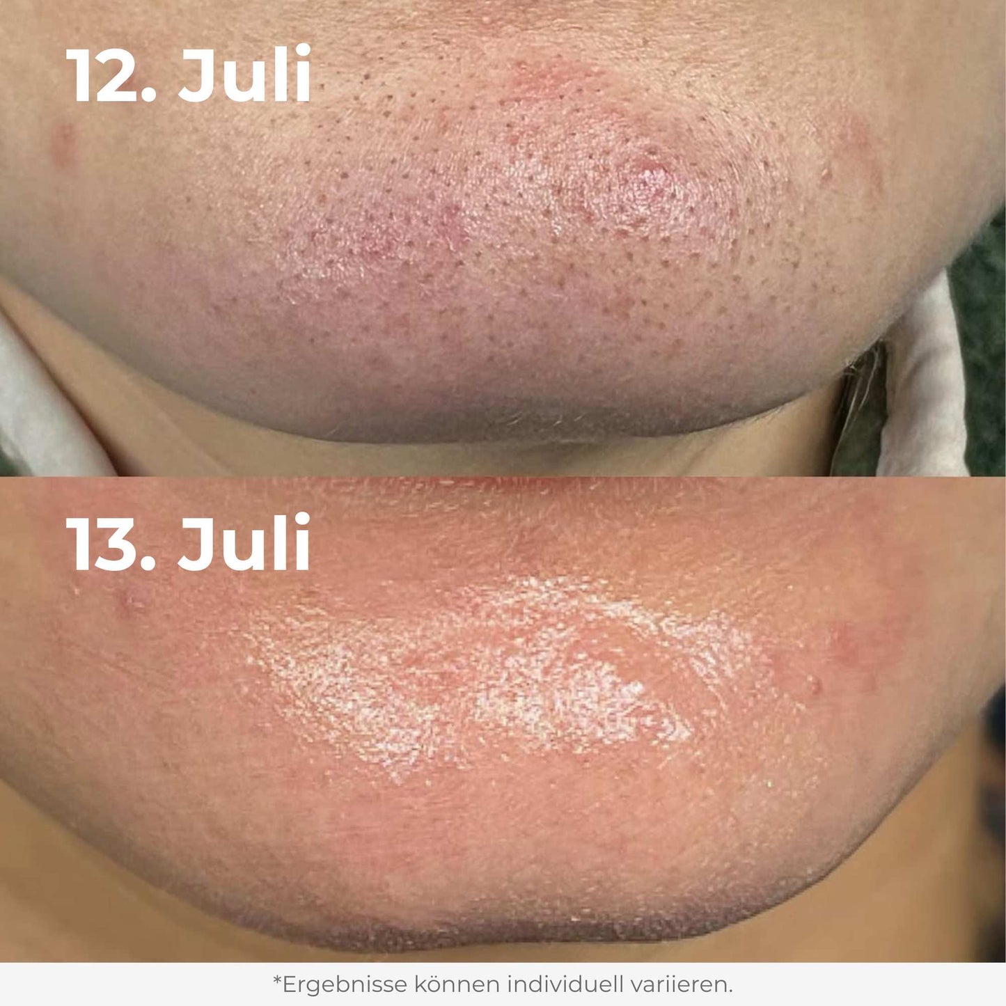 Glow Reis Peeling Duo