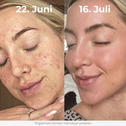 Glow Reis Peeling Duo