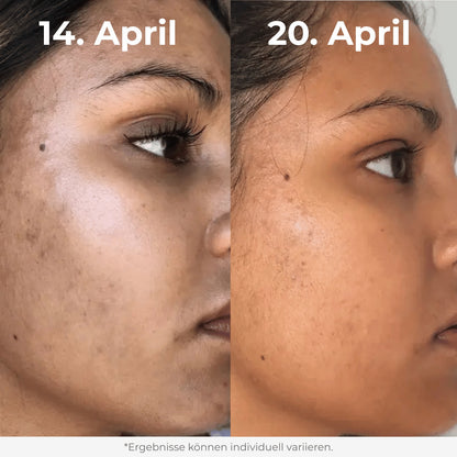 Glow Reis Peeling Duo
