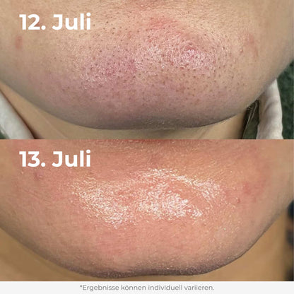 Glow Reis Peeling Duo
