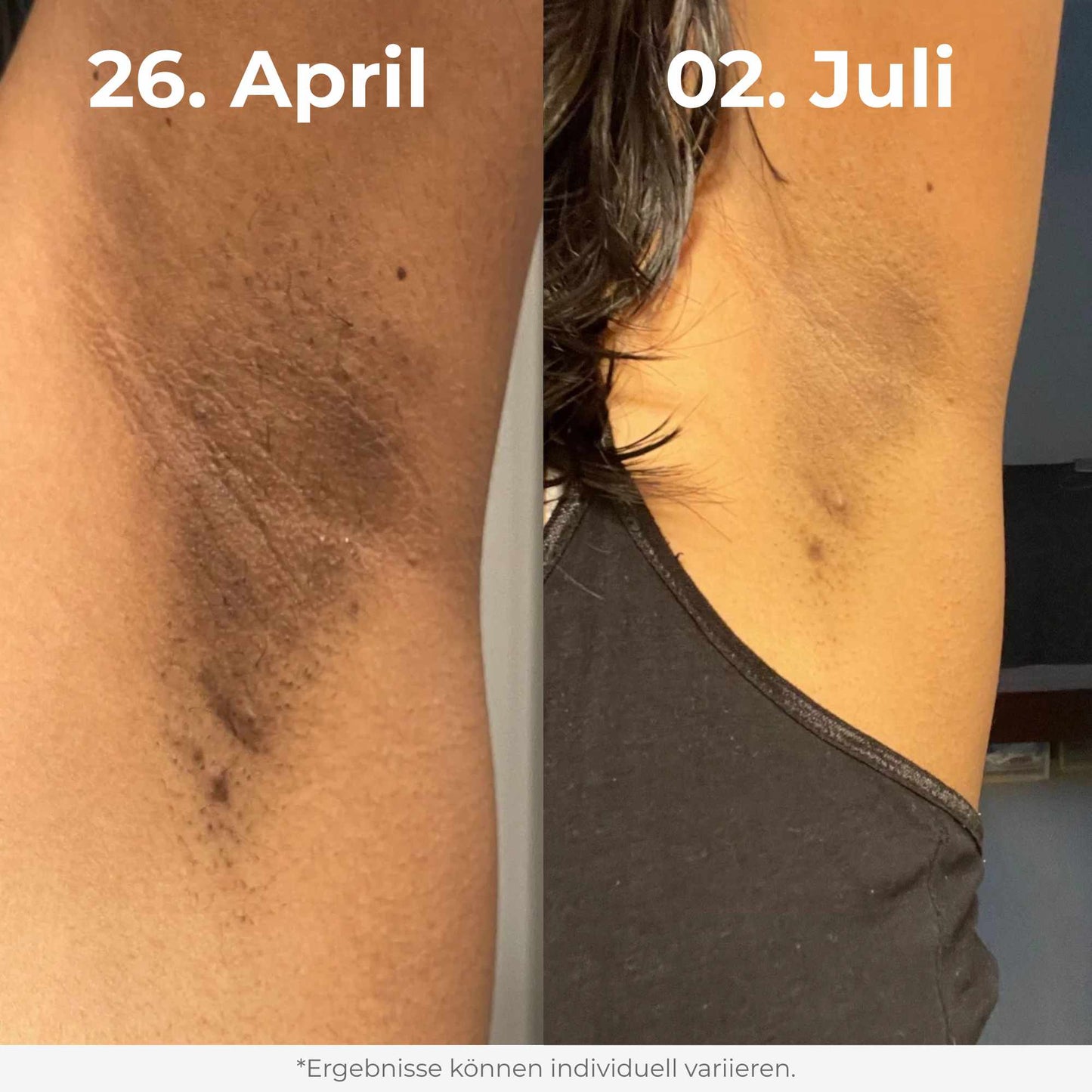 Glow Reis Peeling Duo