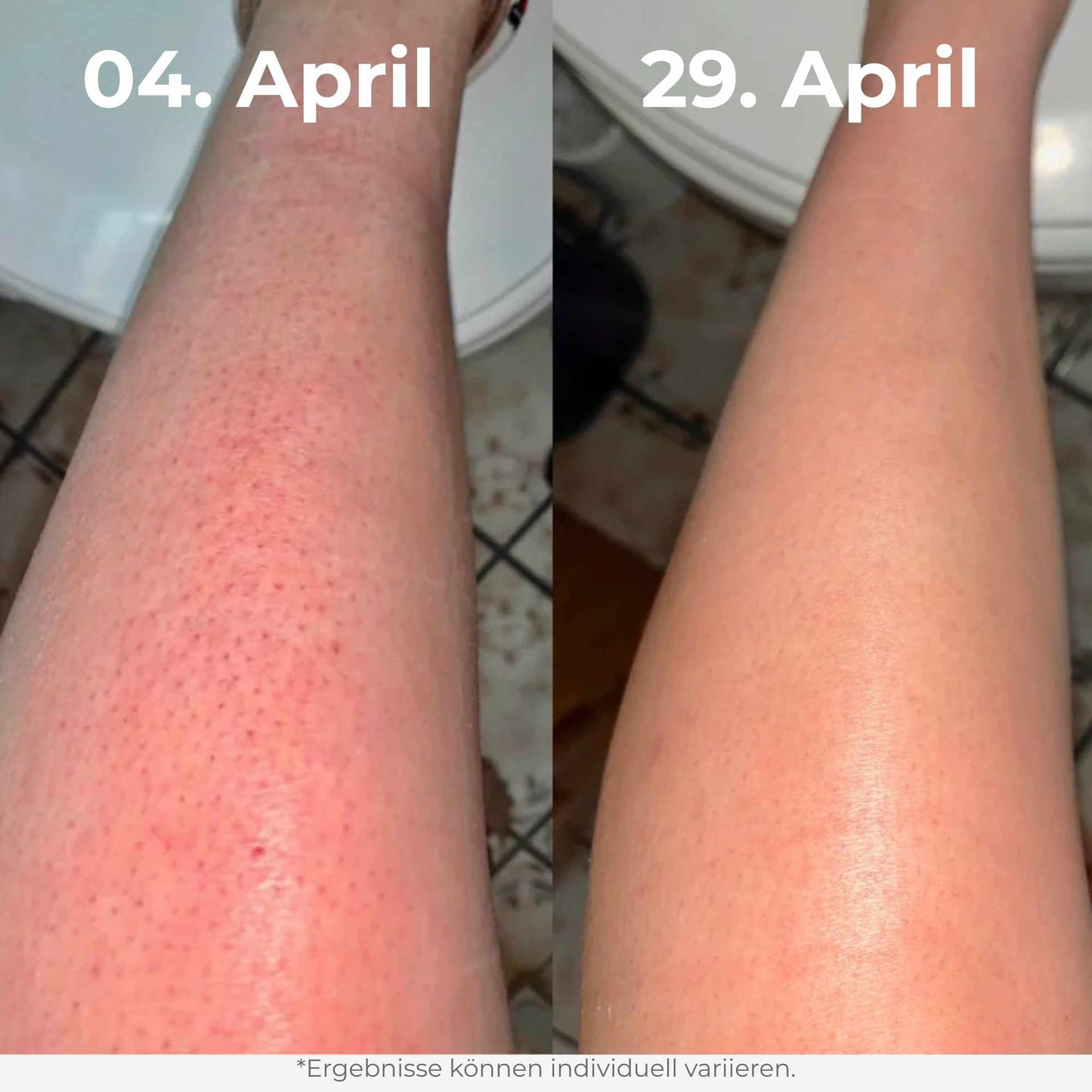 Glow Reis Peeling Duo