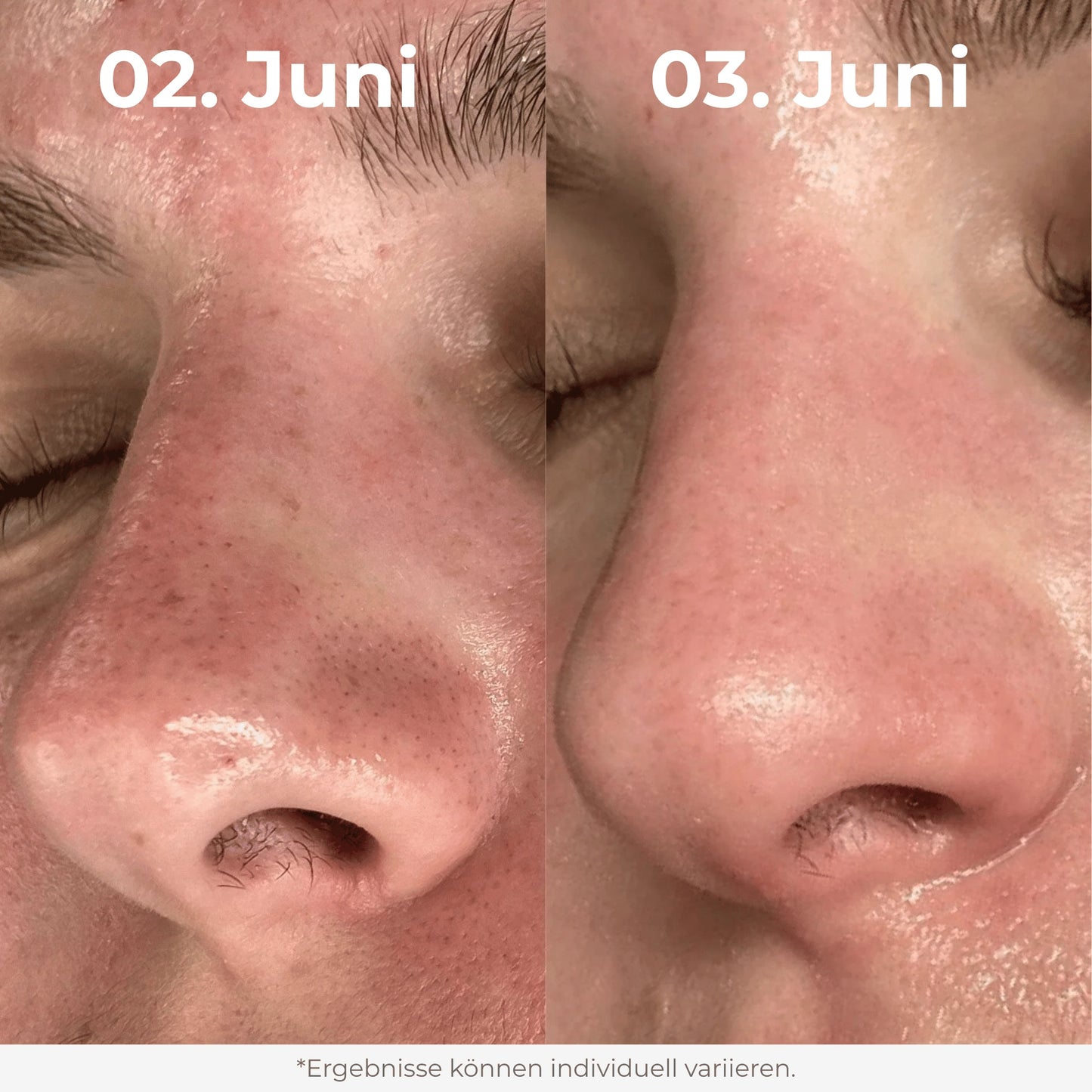 Glow Reis Peeling Duo