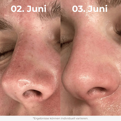 Glow Reis Peeling Duo